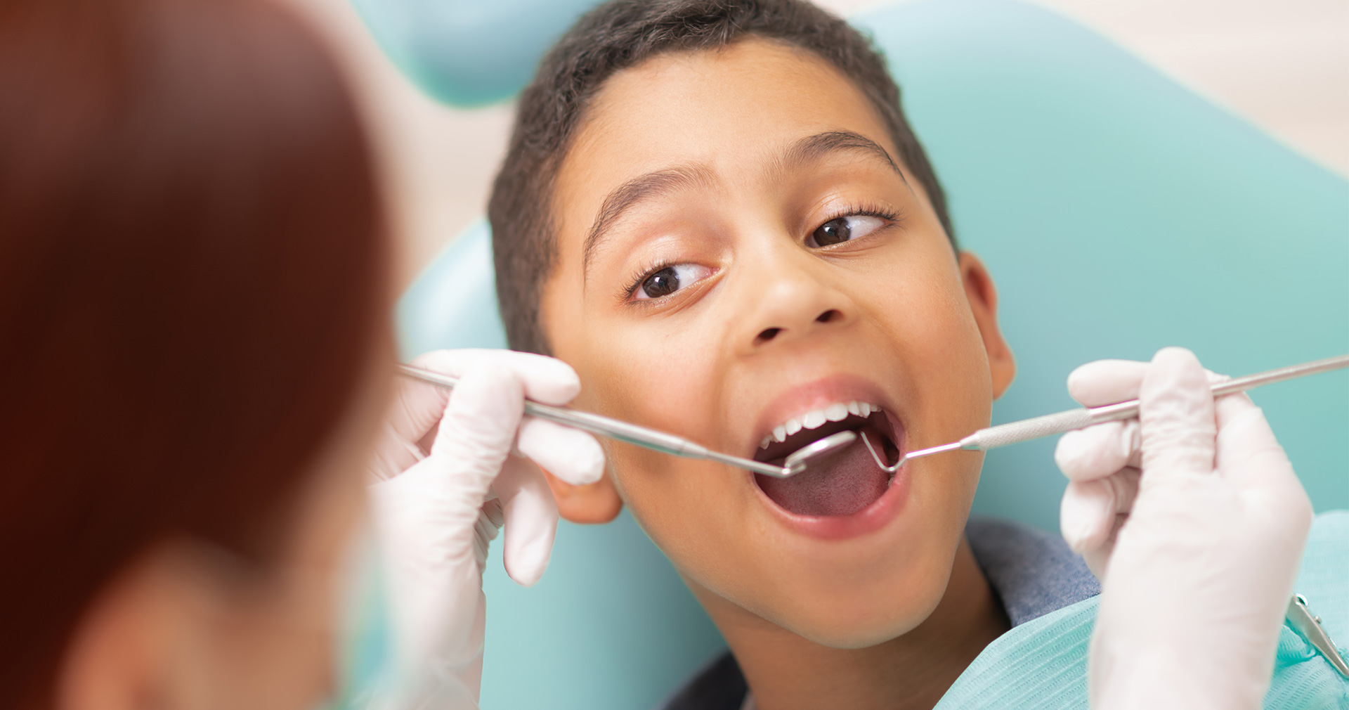 Dia-voluntariado-case Com o apoio de voluntária, Igor, de 11 anos, recupera os dentes da frente